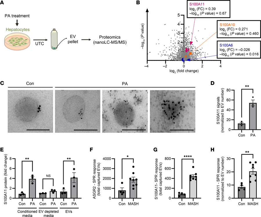 S100A11 is enriched in hepatic EVs.
(A) Schematic representation of unta...