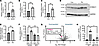 IRE1A regulates lipotoxic ER stress–mediated S100A11 upregulation.