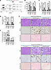 In vivo repression of the murine hepatic LIE lowers CDAHFD-induced steatohe