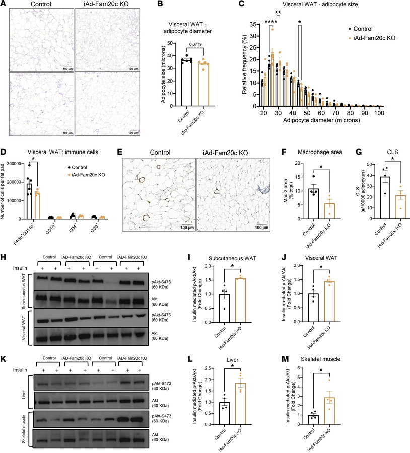 Adipocyte-specific deletion of Fam20c shifts adipocyte size distribution...