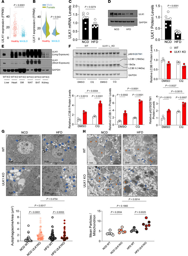Human and murine MASLD associate with reduced ULK1 expression.
(A) Box-a...
