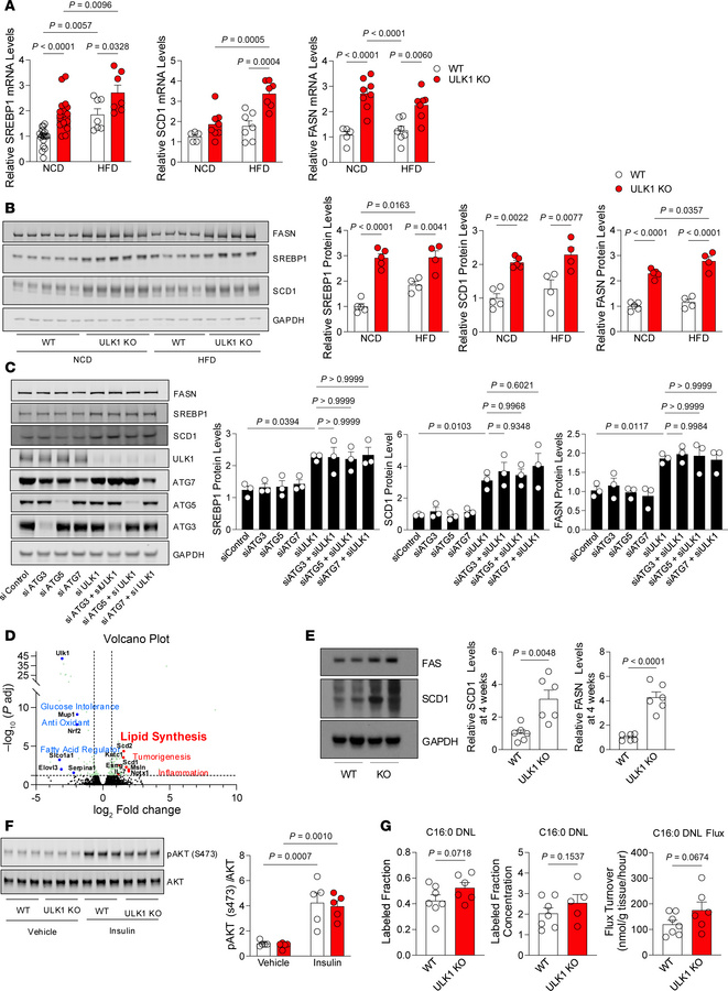 Hepatocyte-specific ULK1 deficiency drives lipogenesis, independent of i...