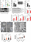 Human and murine MASLD associate with reduced ULK1 expression.
