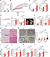 Hepatocyte-specific deficiency of ULK1 induces obesity and metabolic dysfun