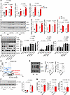 Hepatocyte-specific ULK1 deficiency drives lipogenesis, independent of insu