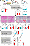 Hepatocyte-specific loss of NCOA3 prevents MASLD due to ULK1 deficiency.