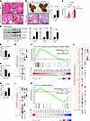 Fibrosis in ULK1-deficient murine livers and changes in lipogenic, inflamma