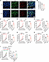 GSDMD deficiency in immune cells promotes tumor growth.