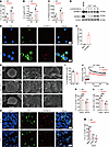 GSDMD-N pores mediate Ca2+ influx for induction of IL-2 in CD4+ T cells.
