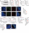 GSDMD activation in CD4+ T cells correlates with survival benefit and immun
