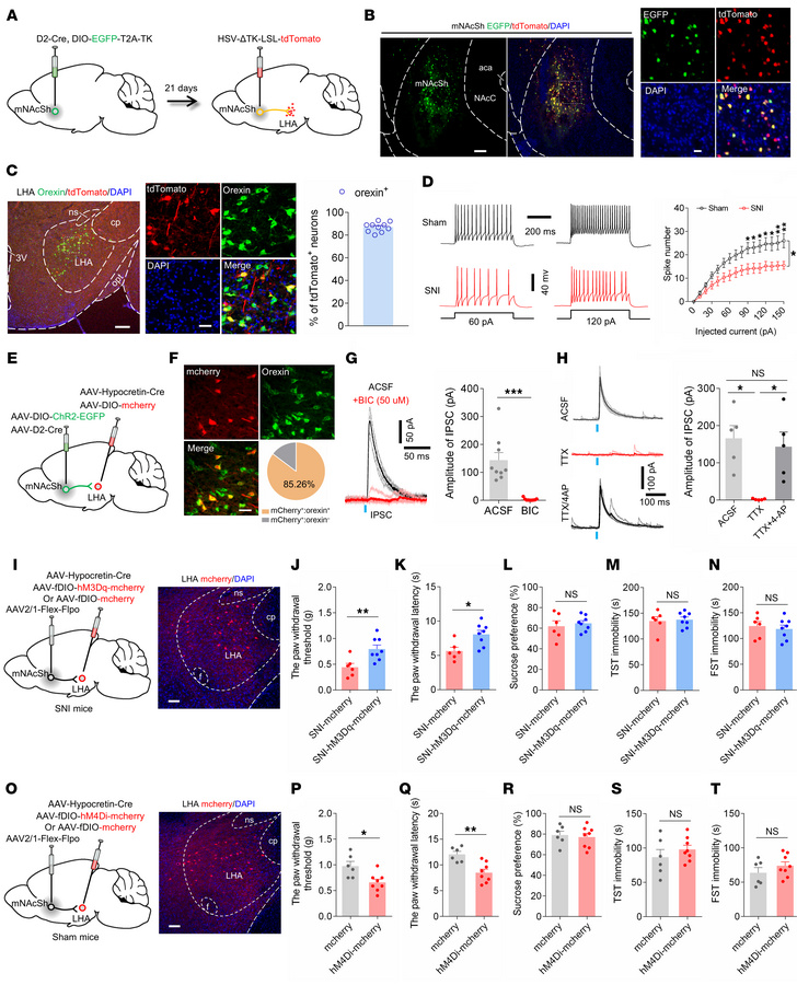 The mNAcShD2-LHAorexin pathway mediates nerve injury–induced pain hypers...