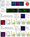 Silencing mNAcShD2-LHA and mNAcShD2-VP projections induces different effect