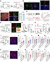 The mNAcShD2-LHAorexin pathway mediates nerve injury–induced pain hypersens