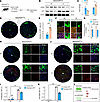 The responses of GFP+-RPE cells to SI injury in 2-month-old Serpine3GFP/+ m