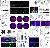 Loss of SERPINE3 accelerates SI-induced RPE degeneration.