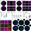 RPE degeneration assay in young and aged Serpine3GFP/GFP mice.