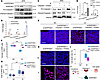 Caspase-1 inhibitor prevents SI-induced cell death in SERPINE3-deficient iR