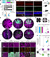 SERPINE3 overexpression partially reduces RPE degeneration after SI injury.
