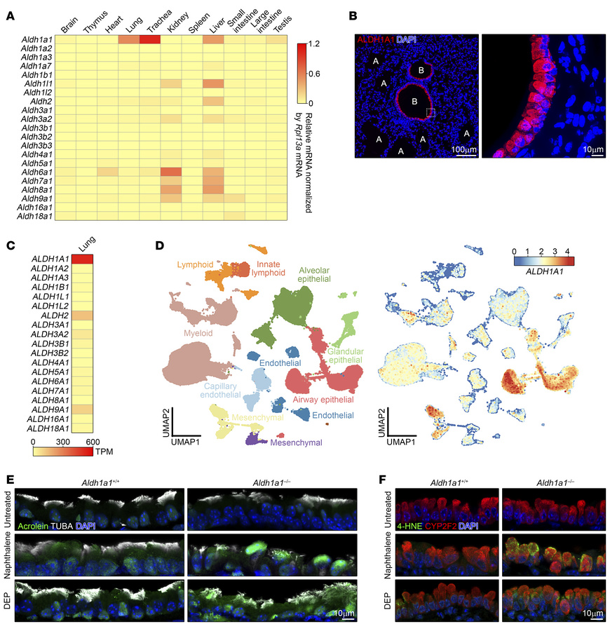 Essential role of ALDH1A1 in detoxifying reactive aldehyde species in th...