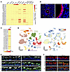 Essential role of ALDH1A1 in detoxifying reactive aldehyde species in the a