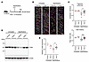 Enhancing ALDH1A1 activity promotes regeneration of cilia and MCC.