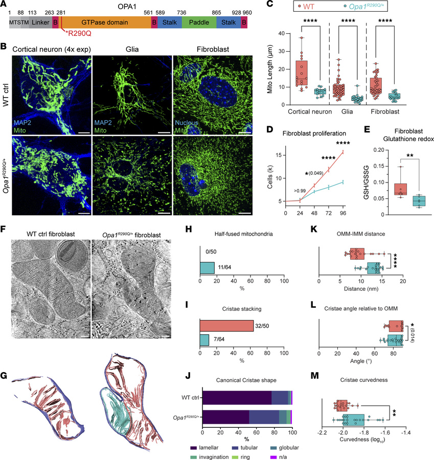 The Opa1R290Q/+ mutation impairs mitochondrial morphology and cristae st...
