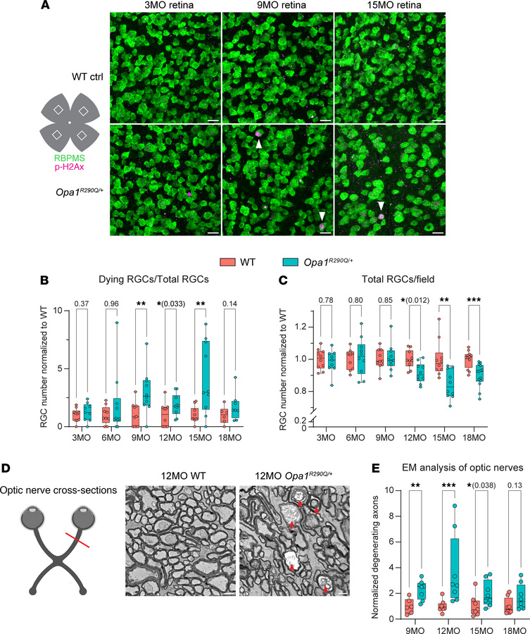 Age-related RGC and optic nerve degeneration in Opa1R290Q/+ mice.
(A) Re...
