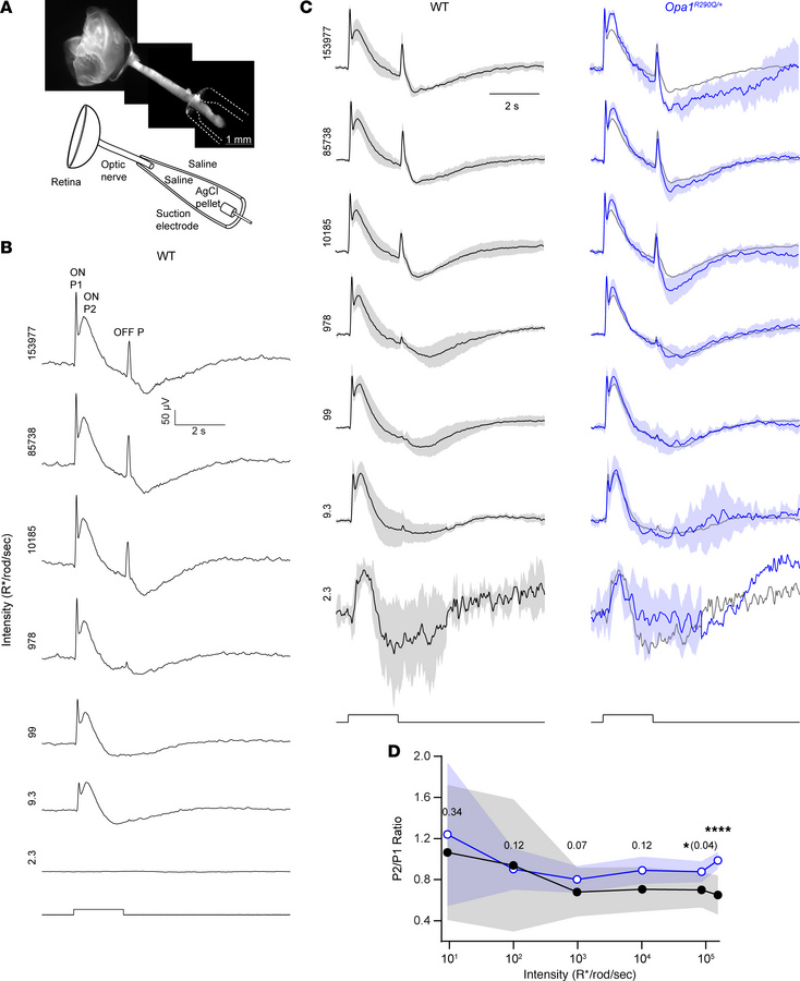 Abnormal CAPs in the optic nerve of Opa1R290Q/+ mice.
(A) Top: The recor...