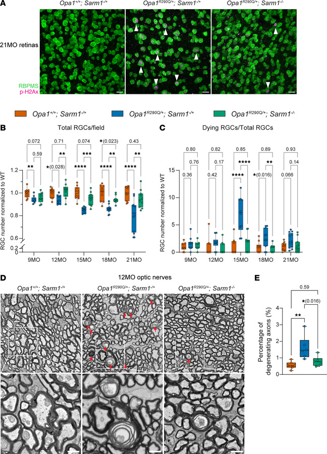 
Sarm1 KO rescues RGC and optic nerve degeneration in Opa1R290Q/+ mice.
...
