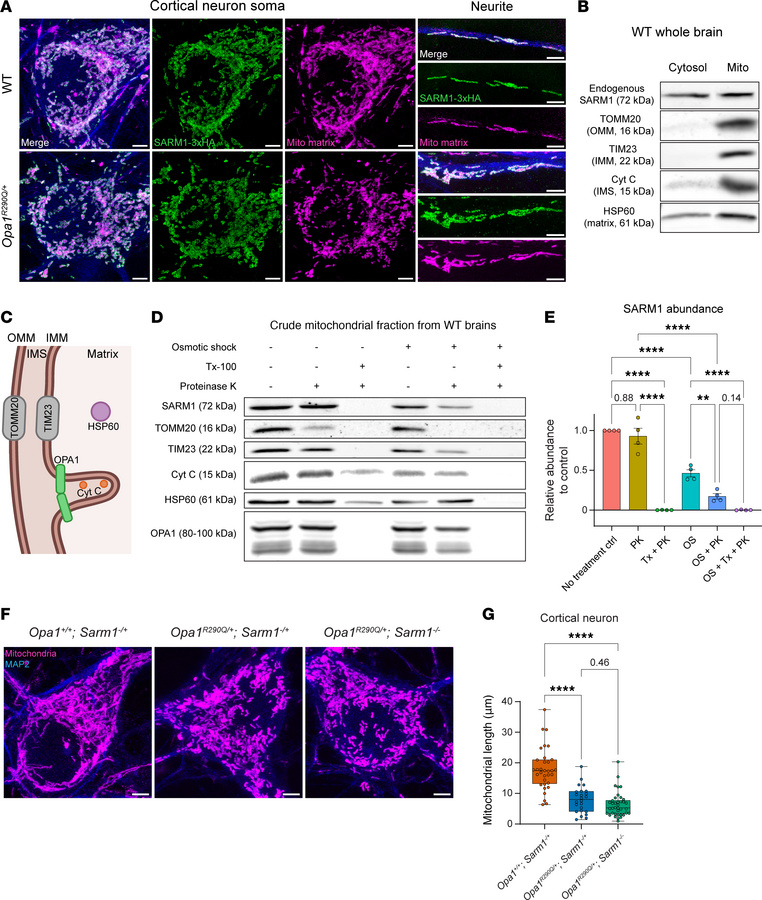 SARM1 is present in the mitochondrial IMS and IMM, and its KO does not r...