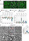 Sarm1 KO rescues RGC and optic nerve degeneration in Opa1R290Q/+ mice.