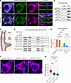 SARM1 is present in the mitochondrial IMS and IMM, and its KO does not resc