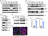 Inhibiting the oncogenic KRAS/MEK/ERK axis upregulates GATA6 expression in