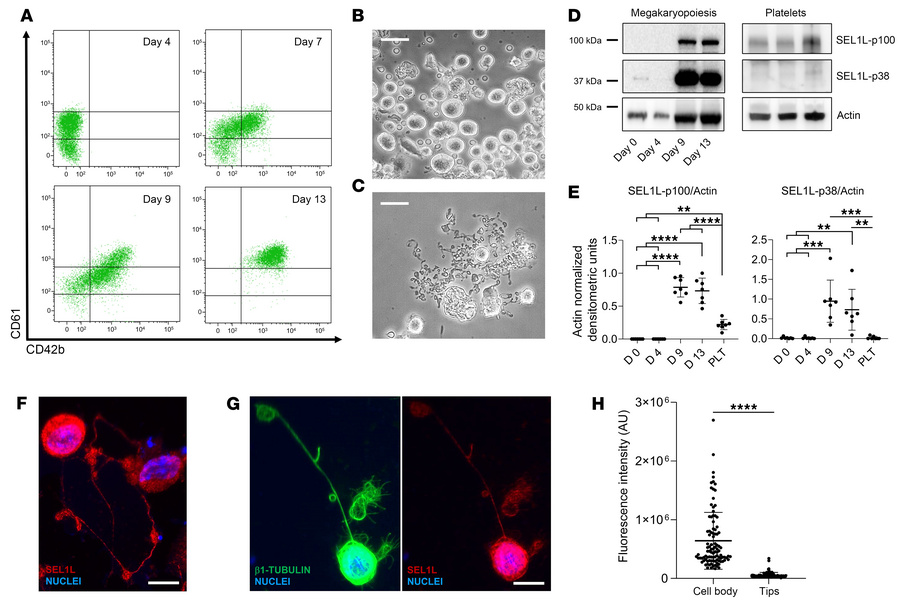 SEL1L is expressed in human cord blood megakaryocytes and platelets.
(A)...