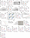 The type I IFN/STAT1 pathway decreases PD-1 expression through activation o