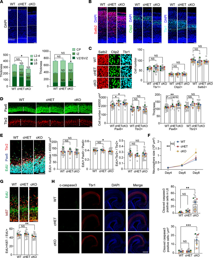 
Ints6 deficiency interferes with neurogenesis and cortical lamination.
...