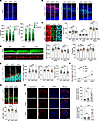 Ints6 deficiency interferes with neurogenesis and cortical lamination.