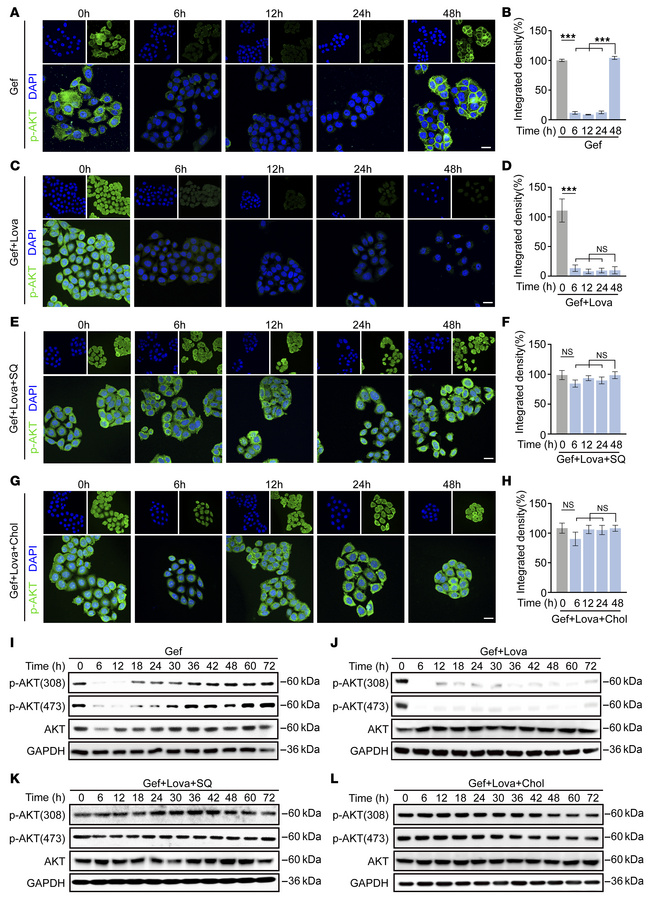 Cholesterol biosynthesis promotes AKT activation.
(A and B) Representati...