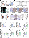 Cholesterol promotes lung cancer cell survival during targeted therapy.