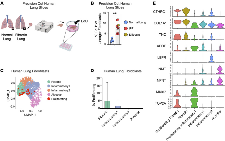Heterogeneity of proliferating fibroblasts in human fibrotic lungs.
(A) ...