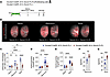 Genetic deletion of proliferating fibroblasts reduces pulmonary fibrosis an