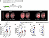 Genetic inhibition of fibroblast proliferation ameliorates lung fibrosis an