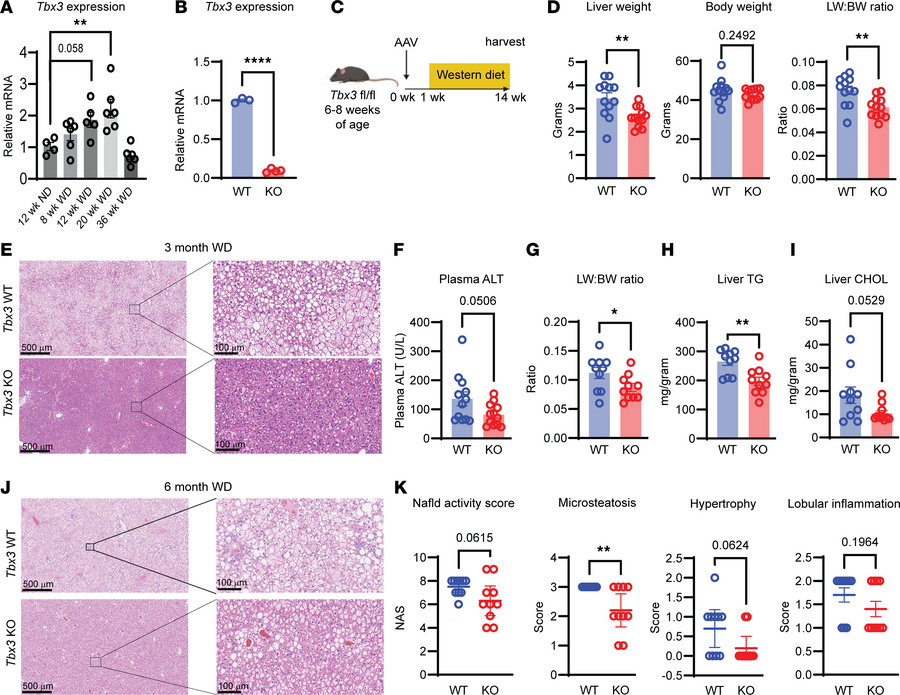Liver-specific Tbx3 deletion protects against MASLD.
(A) Tbx3 mRNA level...