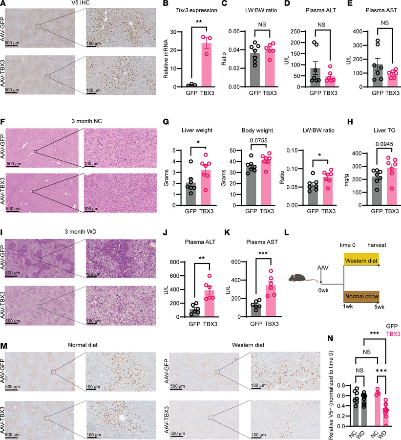 Overexpression of Tbx3 exacerbates MASLD.
(A) Representative V5 staining...