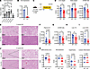 Liver-specific Tbx3 deletion protects against MASLD.