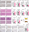 Overexpression of Tbx3 exacerbates MASLD.