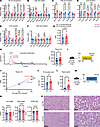 Tbx3 deletion protects against MASLD by transcriptionally upregulating VLDL