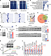 TBX3 regulates VLDL secretion through regulating cholesterol homeostasis.