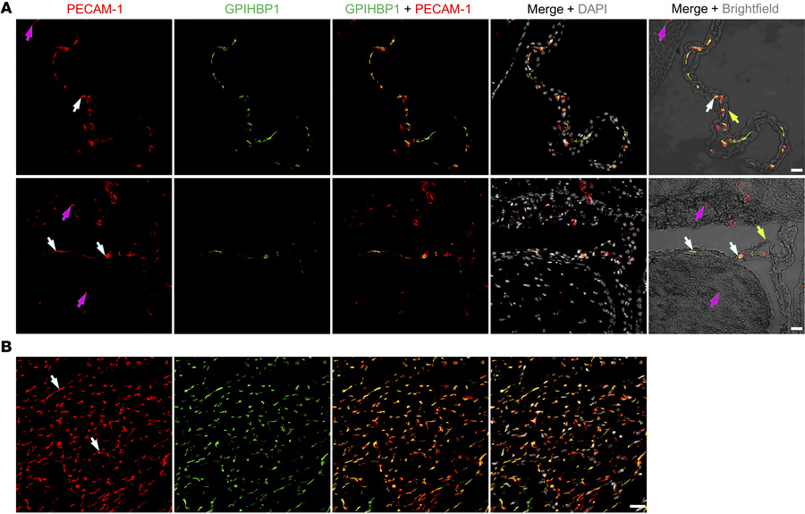 Confocal micrographs revealing GPIHBP1 in PECAM-1–positive capillary ECs...