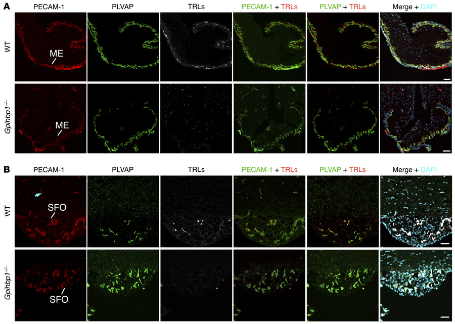 Margination of TRLs along the luminal surface of capillaries in mouse ci...